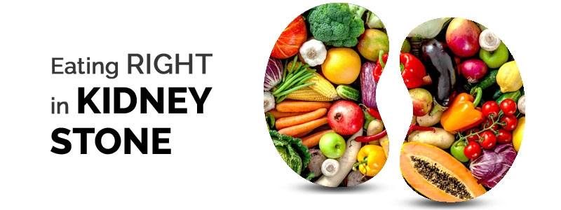 Diet Plan for Kidney Stone - Dietitian Priyanka