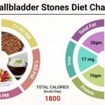 Diet Plan for Gallstones
