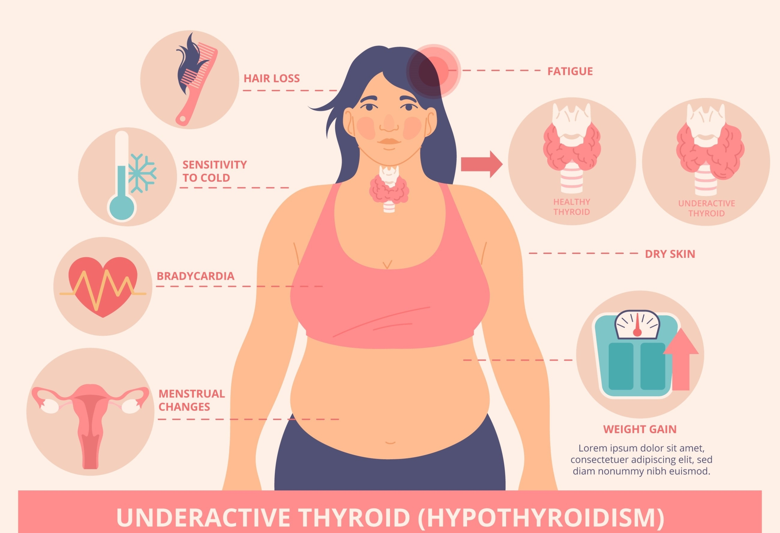 Best Diet for Hypothyroidism: Foods to Eat, Foods to Avoid