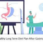 A Healthy Long Term Diet Plan After Gastric Sleeve