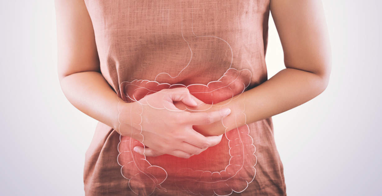 Effective Natural Remedies for Managing SIBO Symptoms!